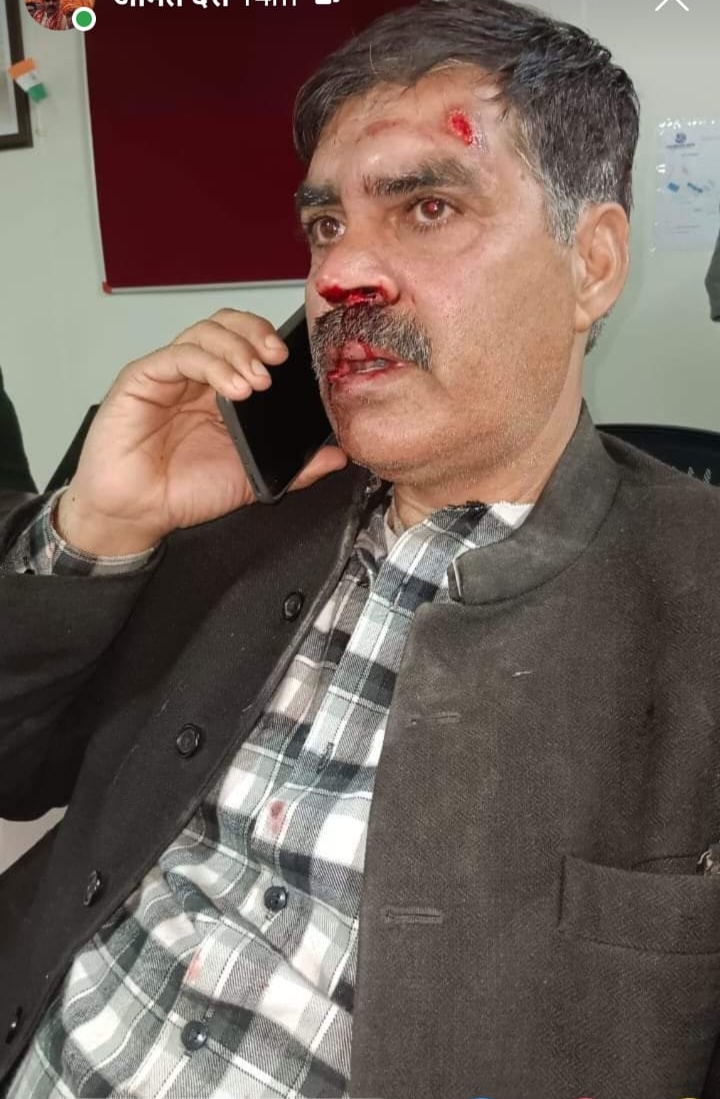 बिलासपुर सदर के पूर्व विधायक बम्बर ठाकुर पर कातिलाना हमला 